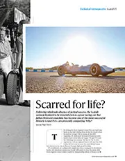 Scarred for life? - Right
